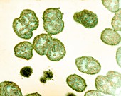 Neisseria gonorrhoeae bacteria,TEM