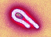 Ebola virus particle,TEM