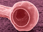 Chabertia roundworm,ESEM