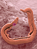 Schistosoma flatworm,ESEM