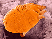 Sarcoptes parasitic mite,ESEM