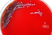 Human plague bacteria culture
