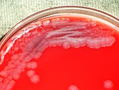 Anthrax bacteria culture
