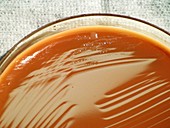 Tularemia bacteria culture