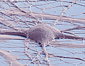 Stem cell-derived neuron,SEM