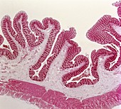 Intestinal villi,light micrograph