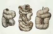 Small intestine,1839 artwork