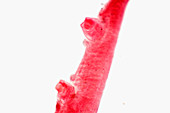 Glochidia or Mussel larvae in fish gills