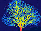 Thermogram