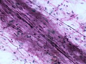 Elastin fibers,light micrograph