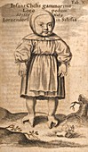 Deformed child,17th century artwork