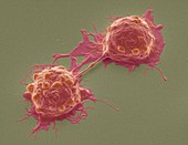 Dividing colorectal cancer cells,SEM