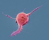 Pluripotent stem cell,SEM