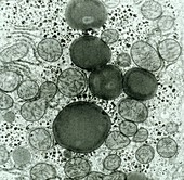 Hepatocyte liver cell,TEM