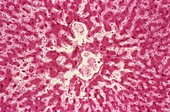 Liver in heart failure,light micrograph