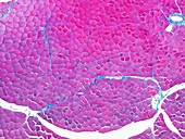 Skeletal muscle tissue,light micrograph