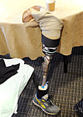 Prosthetic leg