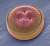 Diatom,SEM