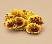 Pluripotent stem cells,SEM