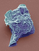 Lymphoma cancer cell,SEM