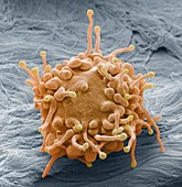 Lymphoma cancer cell,SEM