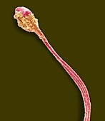 Abnormal human sperm cell,SEM