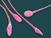 Human sperm cells,SEM