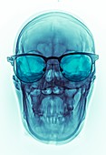 Skull with glasses,X-ray