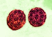 Respiratory cilia,micrograph