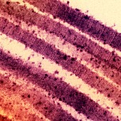 Lung collagen,TEM