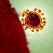 MERS coronavirus particle,TEM