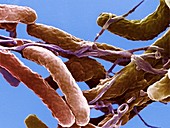 Cholera bacteria,SEM