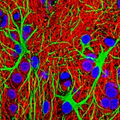 Brain cells,fluorescence micrograph