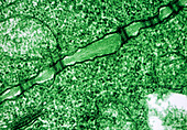 Plasmodesmata plant cell junctions,TEM