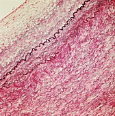 Artery wall,light micrograph