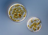 Stephanodiscus diatom,LM