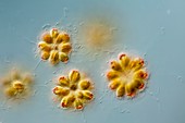Synura alga colonies,LM