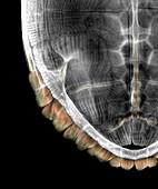 Turtle shell,X-ray