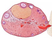 Ovary,light micrograph