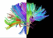 White matter fibres of the human brain