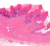 Vagina,light micrograph