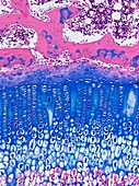 Epiphyseal growth plate,light micrograph