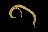 Schistosome fluke worm,light micrograph