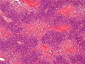 Canine parvovirus,Light micrograph