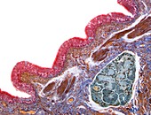 Human lung bronchus,light micrograph