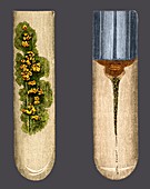 Tuberculosis and cholera,19th century