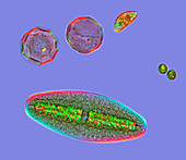 Desmids and amoeba,light micrograph