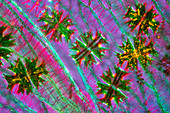 Micrasterias desmids,light micrograph