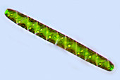 Spirotaenia desmid,light micrograph