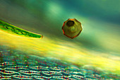 Desmid and amoeba,light micrograph